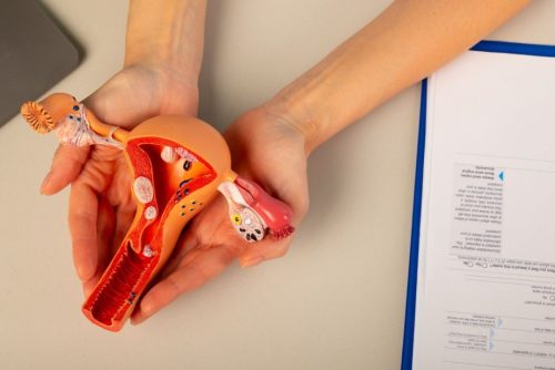 Umbilical Endometriosis (1) (1)