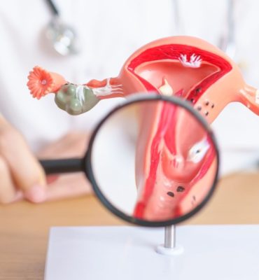 Uteral Endometriosis (1)