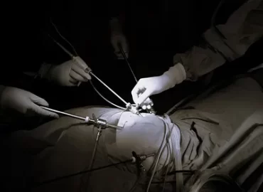 Laproscopic Surgery