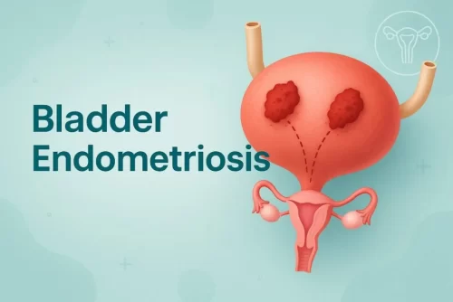 Bladder Endometriosis