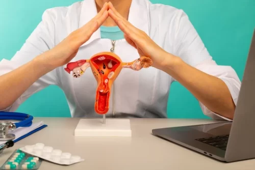 Ovarian Endometriosis