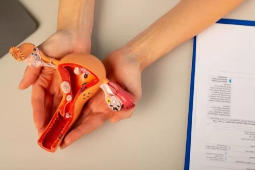 Umbilical Endometriosis