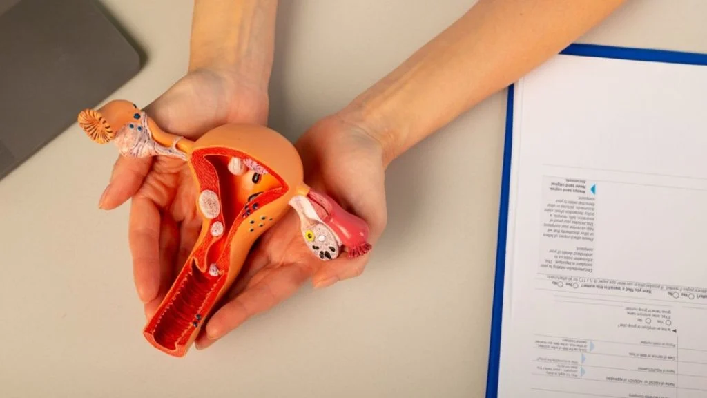 Umbilical Endometriosis