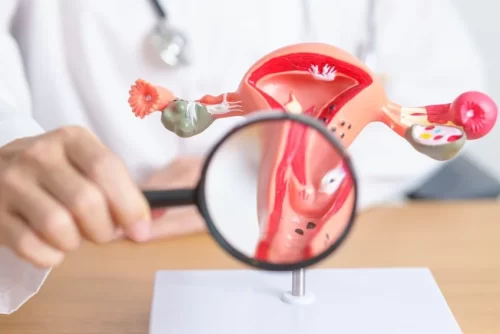 Ureteral Endometriosis