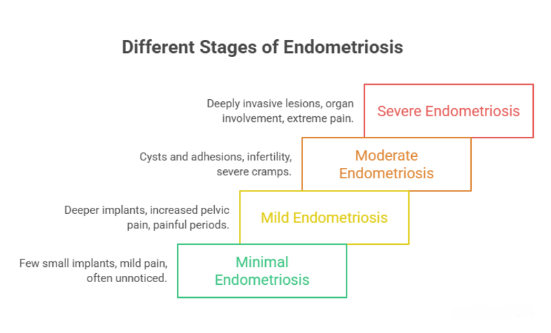 Endometriosis Classification